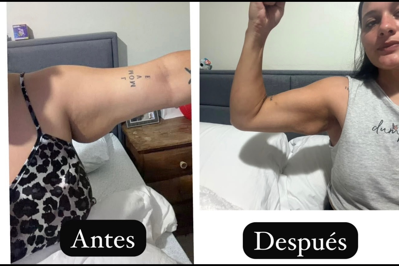 Comparación de antes y después compartida por una alumna de The After: cambios en su brazo